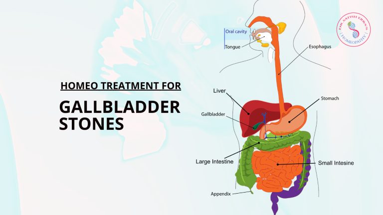 homeopathy treatment for gallbladder stones without operation